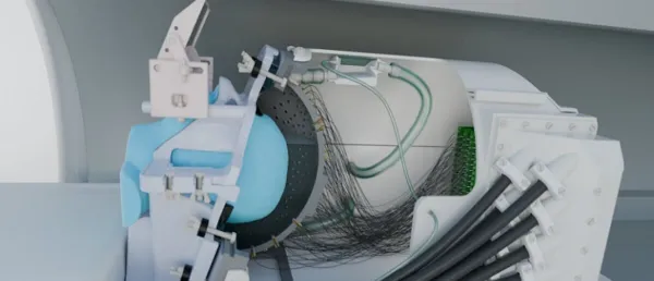 Oxford Researchers Unveil Ultrasound Helmet for Neurological Disorders