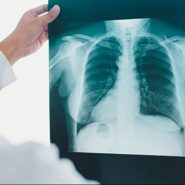 Fischer Medical Subsidiary to Supply 250 AI-Enabled Portable X-Ray Systems to Indonesia