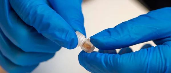 Swallowable Device Collects Microbial Samples from Small Intestine for Improved Diagnostics