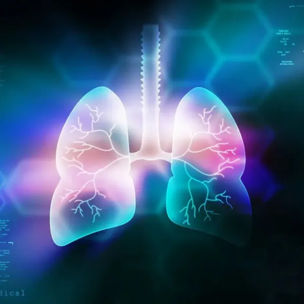 Bristol Myers Squibb Partners With Microsoft for AI-Based Lung Cancer Detection