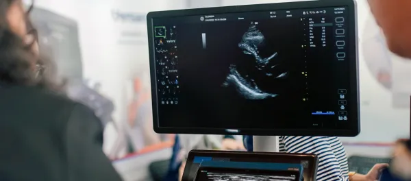 Madha Medical College Installs AI-Powered Acuson Origin Cardiac Ultrasound System