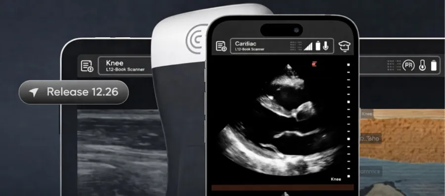 clarius-launches-t-mode-heart-ai-tool-to-train-primary-care-physicians-in-cardiac-ultrasound