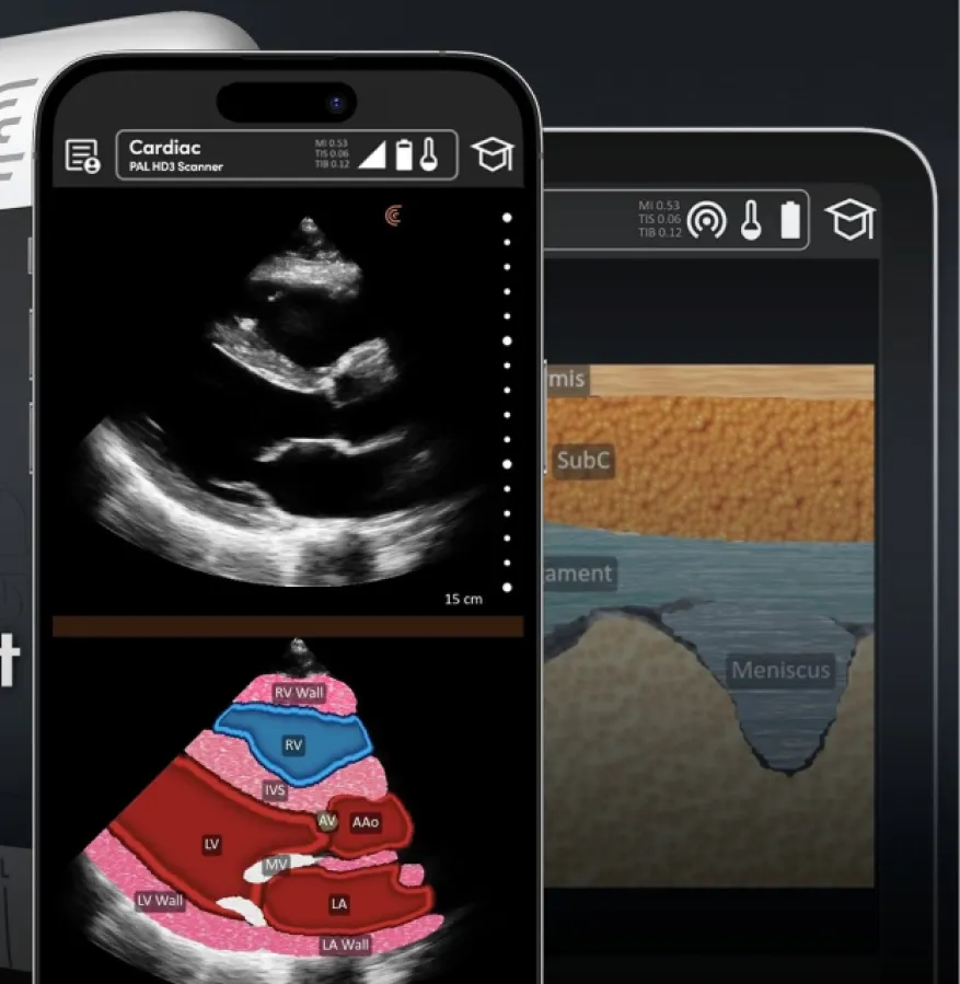 clarius-launches-t-mode-heart-ai-tool-to-train-primary-care-physicians-in-cardiac-ultrasound