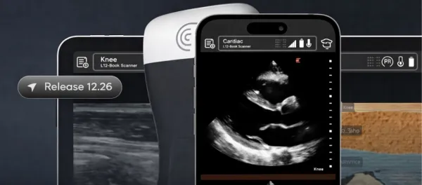 Clarius Launches T-Mode Heart AI Tool to Train Primary Care Physicians in Cardiac Ultrasound