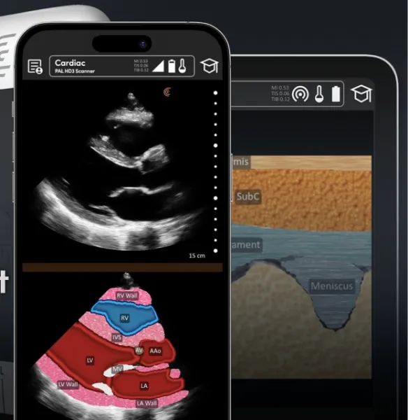 Clarius Launches T-Mode Heart AI Tool to Train Primary Care Physicians in Cardiac Ultrasound