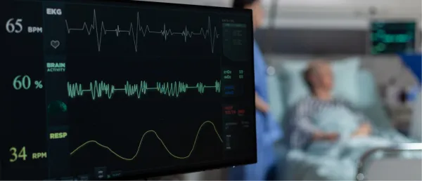 New AI Model Protects Patient Privacy in ECG Data Without Compromising Heart Disease Detection