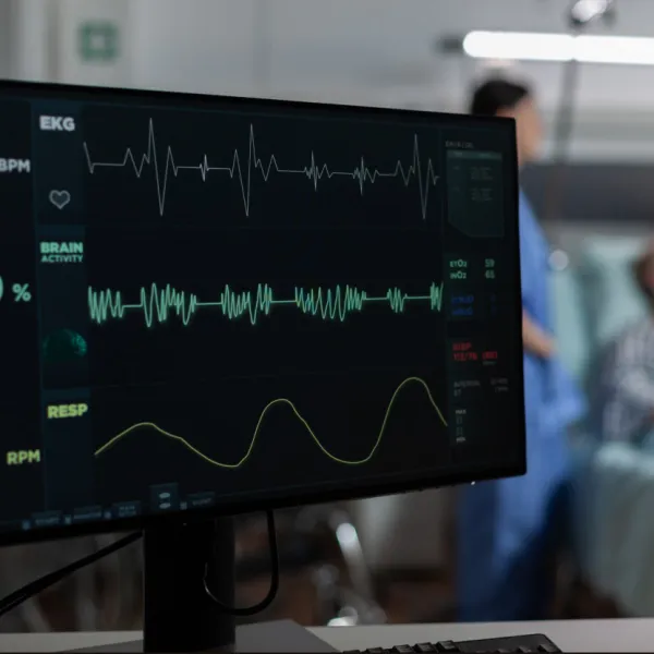 New AI Model Protects Patient Privacy in ECG Data Without Compromising Heart Disease Detection