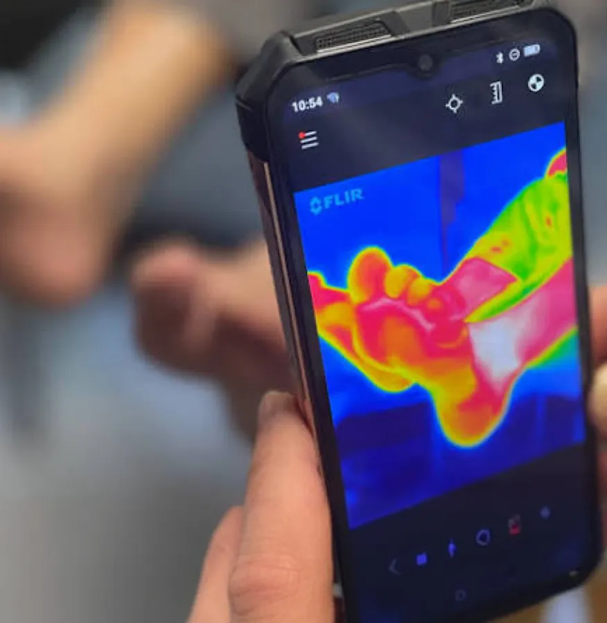 smartphone-thermal-imaging-ai-developed-to-assess-diabetic-foot-ulcer-healing